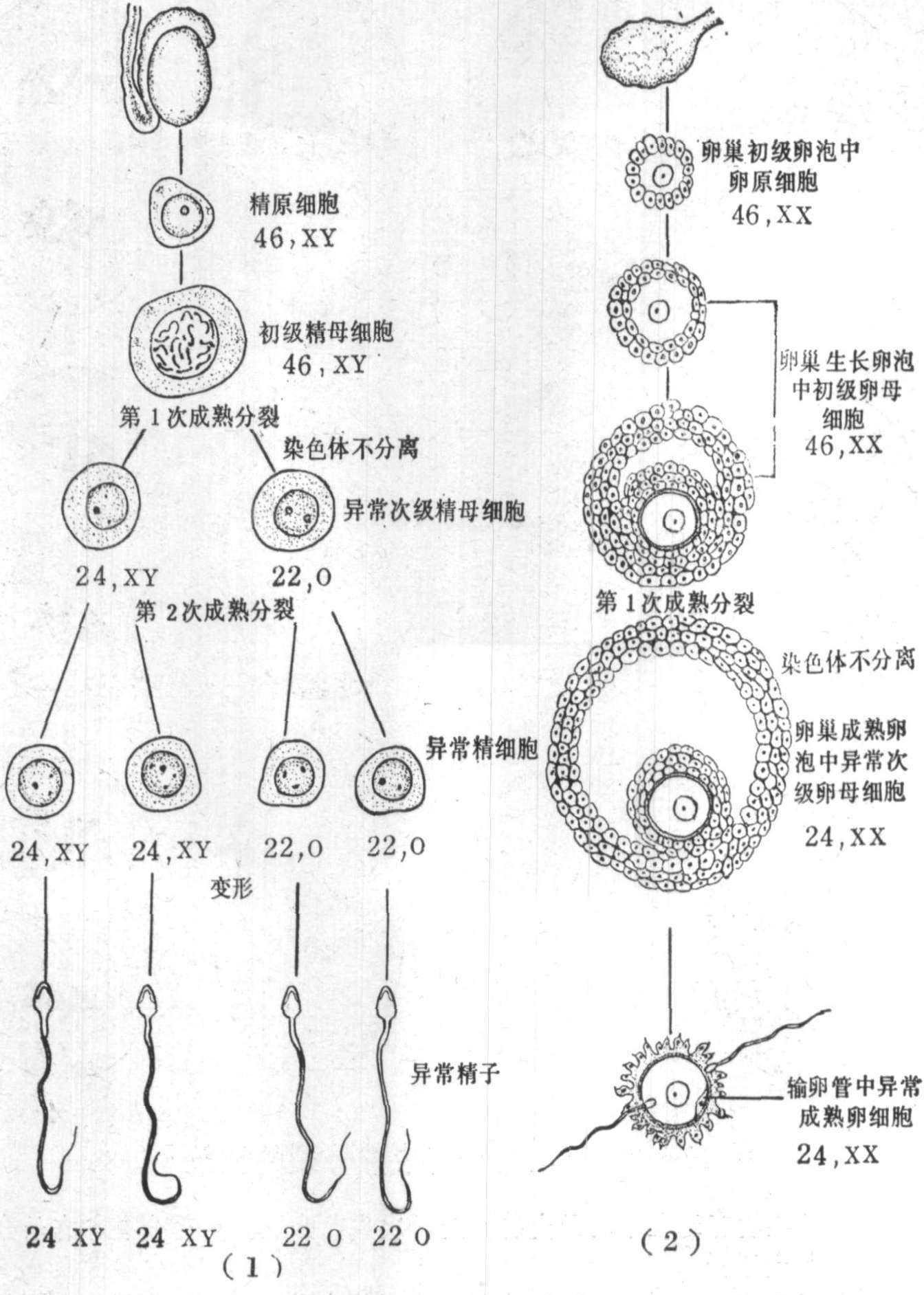 图17～3 生殖细胞发育异常一例